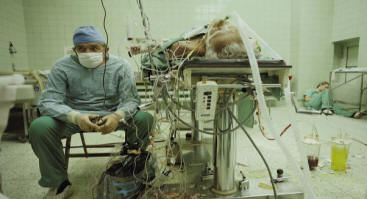 Heart transplant